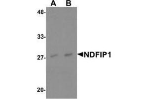 Western blot analysis of NDFIP1 in PC-3 cell lysate with NDFIP1 Antibody  at (A) 0.