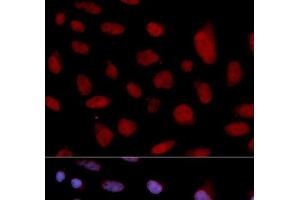 Immunofluorescence analysis of U2OS cells using TNNC1 Polyclonal Antibody (TNNC1 anticorps)
