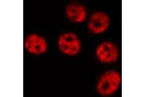 ABIN6267061 staining HeLa by IF/ICC.