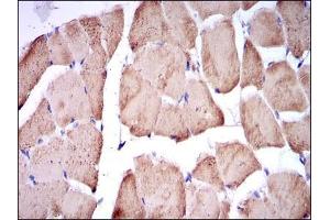 Immunohistochemical analysis of paraffin-embedded striated muscle tissues using TNNI2 mouse mAb with DAB staining. (TNNI2 anticorps)