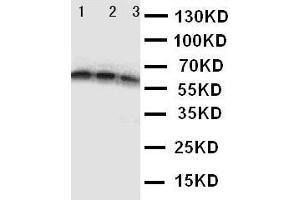 Anti-CD40 antibody,  Western blotting Lane 1: Recombinant Human CD40 Protein 10ng Lane 2: Recombinant Human CD40 Protein 5ng Lane 3: Recombinant Human CD40 Protein 2. (CD40 anticorps  (N-Term))