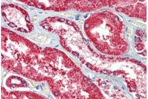 Kidney, Human: Formalin-Fixed, Paraffin-Embedded (FFPE)