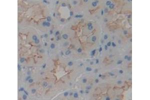 IHC-P analysis of Human Tissue, with DAB staining. (TMEM27 anticorps  (AA 17-137))