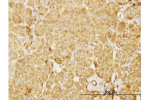 Immunoperoxidase of monoclonal antibody to WASL on formalin-fixed paraffin-embedded human pancreas. (Neural Wiskott-Aldrich syndrome protein (WASL) (AA 97-184) anticorps)