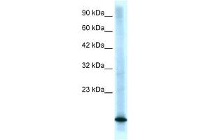 WB Suggested Anti-CDKN2B Antibody Titration:  0. (CDKN2B anticorps  (Middle Region))