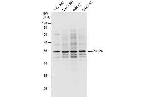 WB Image ZNF24 antibody detects ZNF24 protein by western blot analysis. (ZNF24 anticorps)