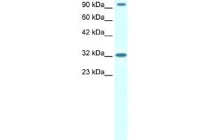 WB Suggested Anti-CIC Antibody Titration:  1. (CIC anticorps  (N-Term))