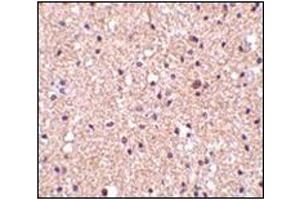Immunohistochemistry of op18 in human brain tissue with this product at 2. (Stathmin 1 anticorps  (C-Term))