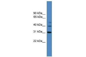 TRIB1 antibody used at 0. (TRIB1 anticorps  (C-Term))