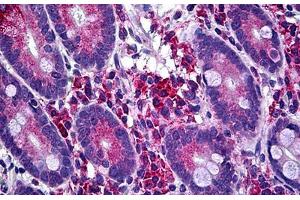 Anti-LIMK1 antibody IHC staining of human small intestine.