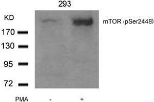 Image no. 3 for anti-Mechanistic Target of Rapamycin (serine/threonine Kinase) (mTOR) (pSer2448) antibody (ABIN196963) (MTOR anticorps  (pSer2448))