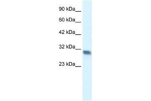 Western Blot showing FHL2 antibody used at a concentration of 1-2 ug/ml to detect its target protein. (FHL2 anticorps  (C-Term))