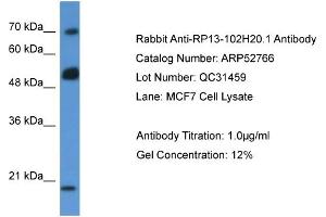 Western Blotting (WB) image for anti-rho GTPase Activating Protein 36 (ARHGAP36) (N-Term) antibody (ABIN2785083) (ARHGAP36 anticorps  (N-Term))