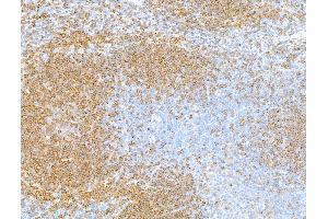 Immunohistochemistry (IHC) image for anti-CD79b Molecule, Immunoglobulin-Associated beta (CD79B) (AA 200-250) antibody (ABIN7454006) (Recombinant CD79b anticorps  (AA 200-250))