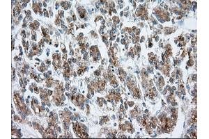 Immunohistochemical staining of paraffin-embedded prostate tissue using anti-MTRF1L mouse monoclonal antibody. (MTRF1L anticorps)