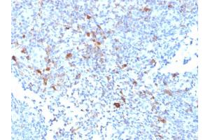 Formalin-fixed, paraffin-embedded human Lymph Node stained with TRAF1 Mouse Monoclonal Antibody (TRAF1/2770). (TRAF1 anticorps  (AA 73-219))