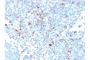 Formalin-fixed, paraffin-embedded human Lymph Node stained with TRAF1 Mouse Monoclonal Antibody (TRAF1/2770).