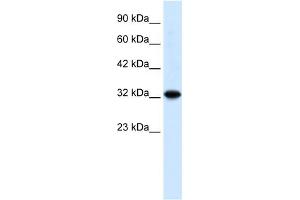 WB Suggested Anti-ZBTB32 Antibody Titration: 0. (ZBTB32 anticorps  (N-Term))