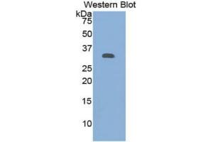 WB of Protein Standard: different control antibodies  against Highly purified E. (Granulin Kit ELISA)