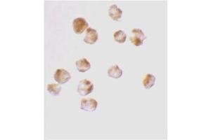 anti-Acinus / ACIN1 (p17) (C-Term) antibody