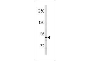 SUZ12 Antibody (C-term) (ABIN1881858 and ABIN2843258) western blot analysis in Ramos cell line lysates (35 μg/lane). (SUZ12 anticorps  (C-Term))