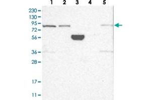 Western blot analysis of Lane 1: RT-4, Lane 2: U-251 MG, Lane 3: Human Plasma, Lane 4: Liver, Lane 5: Tonsil with SCLT1 polyclonal antibody .