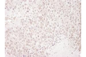 Immunohistochemistry (IHC) image for anti-Gem (Nuclear Organelle) Associated Protein 4 (GEMIN4) (C-Term) antibody (ABIN7448579)