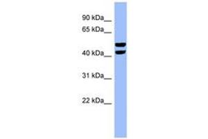 Image no. 1 for anti-6-phosphofructo-2-Kinase/fructose-2,6-Biphosphatase 4 (PFKFB4) (N-Term) antibody (ABIN6741800) (PFKFB4 anticorps  (N-Term))