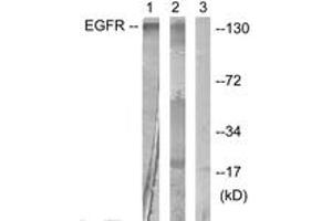 Western blot analysis of extracts from HuvEc cells, treated with Serum 20% 30', using EGFR (Ab-1016) Antibody. (EGFR anticorps  (AA 986-1035))