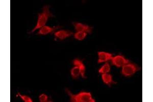 ABIN6277548 staining Hela by IF/ICC. (CHRM5 anticorps  (C-Term))