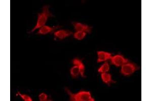 ABIN6277548 staining Hela by IF/ICC. (CHRM5 anticorps  (C-Term))