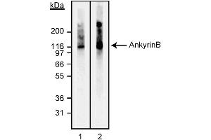 Western blot analysis of Ankyrin B.