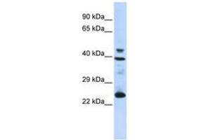 Image no. 1 for anti-Selenoprotein P (SEPP1) (AA 35-84) antibody (ABIN6743265) (Selenoprotein P anticorps  (AA 35-84))