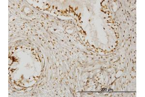 Immunoperoxidase of monoclonal antibody to KLHDC4 on formalin-fixed paraffin-embedded human prostate. (KLHDC4 anticorps  (AA 1-463))