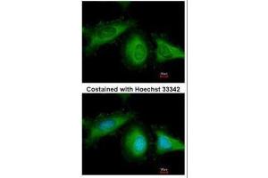 ICC/IF Image Immunofluorescence analysis of methanol-fixed HeLa, using HSC70, antibody at 1:200 dilution. (Hsc70 anticorps  (C-Term))