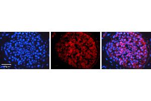 Rabbit Anti-HDAC4 Antibody   Formalin Fixed Paraffin Embedded Tissue: Human Testis Tissue Observed Staining: Cytoplasm Primary Antibody Concentration: 1:100 Other Working Concentrations: N/A Secondary Antibody: Donkey anti-Rabbit-Cy3 Secondary Antibody Concentration: 1:200 Magnification: 20X Exposure Time: 0.