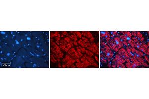 Rabbit Anti-AKR1B1 Antibody Catalog Number: ARP48179_P050 Formalin Fixed Paraffin Embedded Tissue: Human heart Tissue Observed Staining: Cytoplasmic Primary Antibody Concentration: N/A Other Working Concentrations: 1:600 Secondary Antibody: Donkey anti-Rabbit-Cy3 Secondary Antibody Concentration: 1:200 Magnification: 20X Exposure Time: 0.