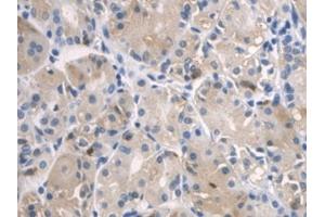 IHC-P analysis of Human Stomach Tissue, with DAB staining. (SPRY2 anticorps  (AA 116-305))