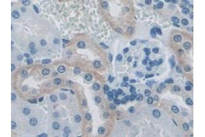 Detection of RANk in Mouse Kidney Tissue using Polyclonal Antibody to Receptor Activator Of Nuclear Factor Kappa B (RANk)
