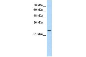 WB Suggested Anti-TSHR Antibody Titration:  0. (TSH receptor anticorps  (C-Term))