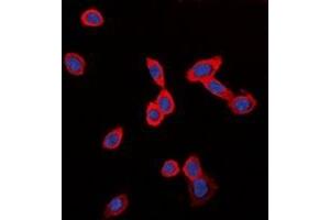 Immunofluorescent analysis of GPR126 staining in LOVO cells.