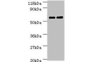 Western blot All lanes: Ces1c antibody at 2 μg/mL Lane 1: Mouse liver tissue Lane 2: Rat liver tissue Secondary Goat polyclonal to rabbit IgG at 1/10000 dilution Predicted band size: 62 kDa Observed band size: 62 kDa (CES1C anticorps  (AA 19-550))