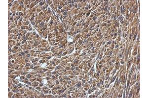 Image no. 1 for anti-Vesicle-Associated Membrane Protein 1 (Synaptobrevin 1) (VAMP1) (AA 1-105) antibody (ABIN1501694)