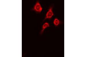 ABIN6269362 staining A431 cells by IF/ICC. (PKC mu anticorps  (Internal Region))
