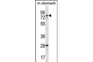 WBSCR17 Antibody (C-term) (ABIN657083 and ABIN2846243) western blot analysis in mouse stomach tissue lysates (35 μg/lane). (WBSCR17 anticorps  (C-Term))
