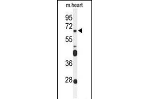 Western blot analysis of FZD4 Antibody in mouse heart tissue lysates (35ug/lane) (FZD4 anticorps  (C-Term))