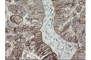 Image no. 7 for anti-Diphthamide Biosynthesis Protein 2 (DPH2) antibody (ABIN1497892)