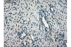Immunohistochemical staining of paraffin-embedded Ovary tissue using anti-FERMT2mouse monoclonal antibody. (FERMT2 anticorps)