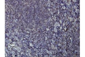Immunoperoxidase of monoclonal antibody to EPHB3 on formalin-fixed paraffin-embedded human tonsil. (EPH Receptor B3 anticorps  (AA 899-997))