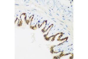 Immunohistochemistry of paraffin-embedded rat lung using KIAA1456 antibody (ABIN5974326) at dilution of 1/200 (40x lens). (KIAA1456 anticorps)